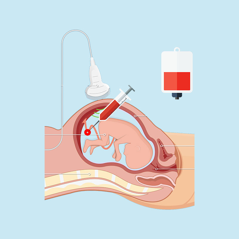 Fetal Therapy – Neofetal México